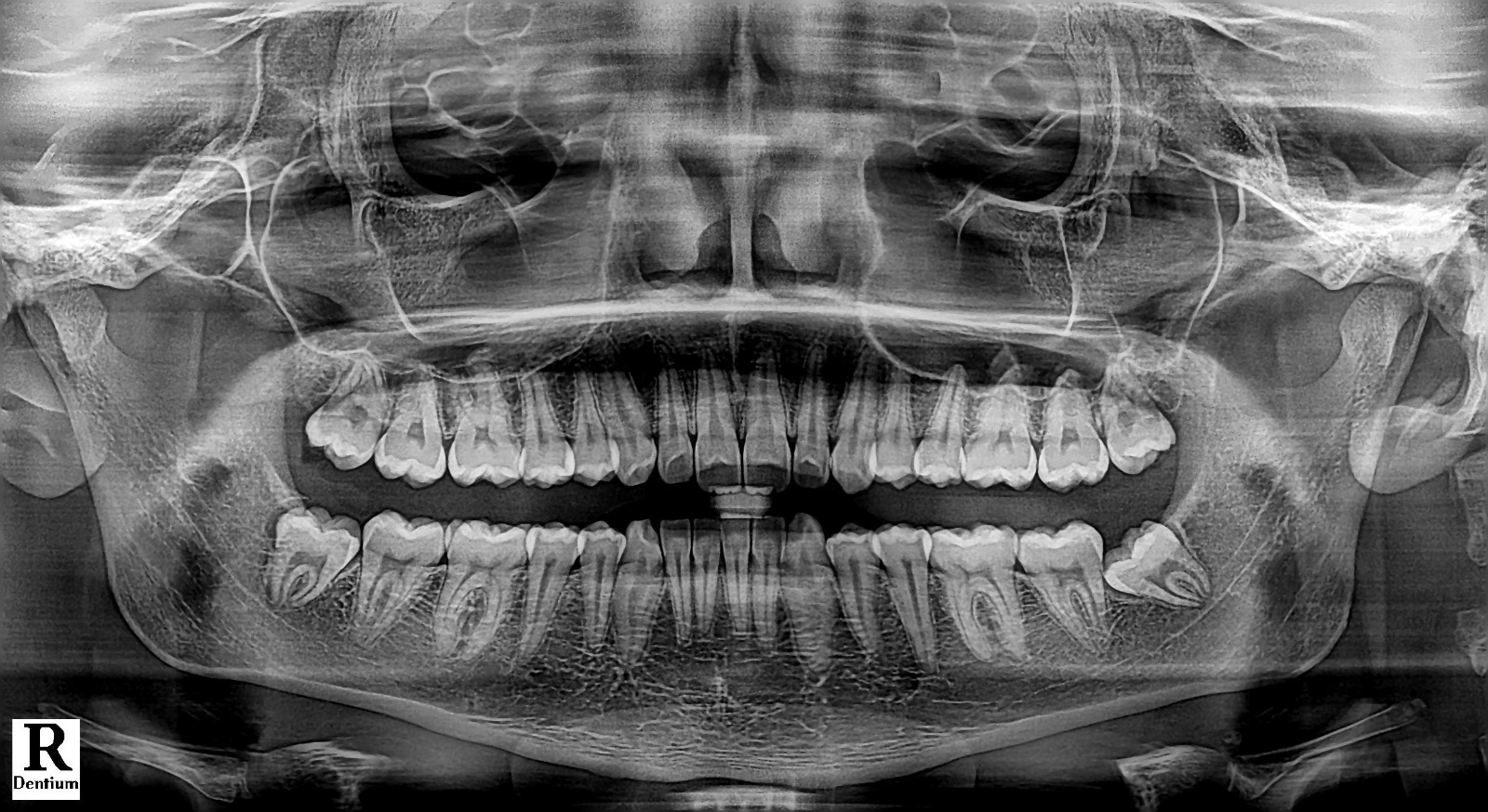 Panoramic X-ray Machine - Central Clinic