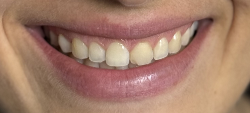 Before