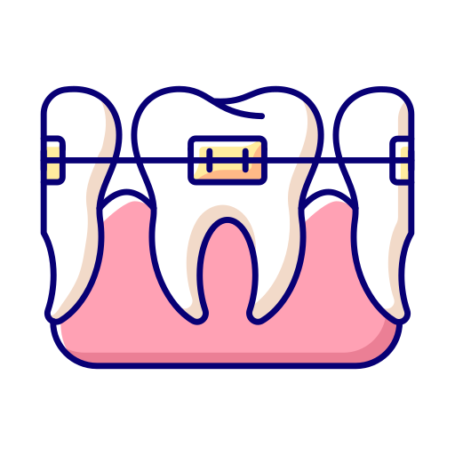 Înghesuiri Dentare