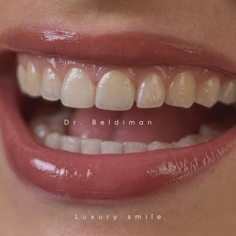 Tratamente dentare la Central Clinic