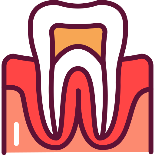 Gingivită